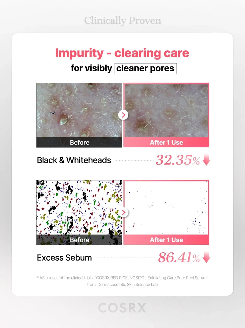 COSRX RED RICE INOSITOL Exfoliating Care Pore Wash-Off Peel Serum